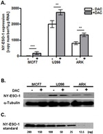 NY-ESO-1 Antibody in Western Blot (WB)