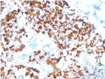 IL3RA/CD123 Antibody in Immunohistochemistry (Paraffin) (IHC (P))