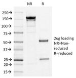 IL3RA/CD123 Antibody in SDS-PAGE (SDS-PAGE)