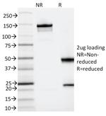 IL3RA/CD123 (Acute Myeloid Leukemia Marker) Antibody in SDS-PAGE (SDS-PAGE)