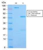 IL3RA/CD123 Antibody in SDS-PAGE (SDS-PAGE)