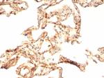 IL-6 (Interleukin-6)/Interferon beta-2 (Hybridoma Growth Factor) Antibody in Immunohistochemistry (Paraffin) (IHC (P))