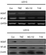 MGMT Antibody in Western Blot (WB)