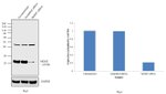 MGMT Antibody in Western Blot (WB)