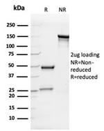 Interleukin-7 (IL-7) Antibody in SDS-PAGE (SDS-PAGE)