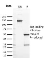 CD127/IL7R Antibody in SDS-PAGE (SDS-PAGE)