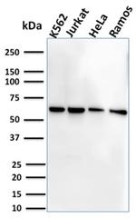 CD127/IL7R Antibody in Western Blot (WB)