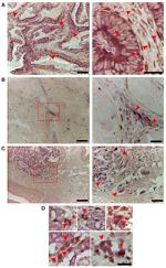 PKP3 Antibody in Immunohistochemistry (IHC)