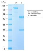 Interleukin 10 (IL10) Antibody in SDS-PAGE (SDS-PAGE)