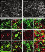 Connexin 32 Antibody in Immunohistochemistry (IHC)