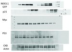 Nkx3.1 Antibody in Western Blot (WB)