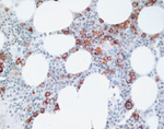 CD138 Antibody in Immunohistochemistry (IHC)