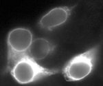 LRP5 Antibody in Immunocytochemistry (ICC/IF)