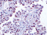 CKS1 Antibody in Immunohistochemistry (IHC)