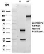 Interleukin-15 (IL-15) Antibody in SDS-PAGE (SDS-PAGE)