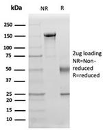 Interleukin-15 (IL-15) Antibody in SDS-PAGE (SDS-PAGE)