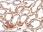 CD137/4-1BB/TNFRSF9 Antibody in Immunohistochemistry (Paraffin) (IHC (P))