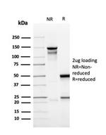 CD137/4-1BB/TNFRSF9 Antibody in SDS-PAGE (SDS-PAGE)