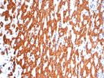 IL-6 (Interleukin-6)/Interferon beta-2 (Hybridoma Growth Factor) Antibody in Immunohistochemistry (Paraffin) (IHC (P))