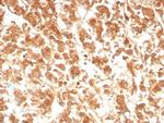 IL-18 (Interleukin-6)/Interferon beta-2 (Hybridoma Growth Factor) Antibody in Immunohistochemistry (Paraffin) (IHC (P))