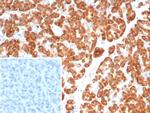 IL-6 (Interleukin-6)/Interferon beta-2 (Hybridoma Growth Factor) Antibody in Immunohistochemistry (Paraffin) (IHC (P))