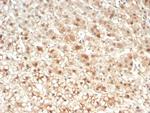 IL-6 (Interleukin-6)/Interferon beta-2 (Hybridoma Growth Factor) Antibody in Immunohistochemistry (Paraffin) (IHC (P))