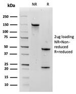 Aquaporin 4 (AQP4) Antibody in SDS-PAGE (SDS-PAGE)