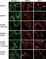 JAM-A (CD321) Antibody in Immunohistochemistry (IHC)