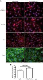 JAM-A (CD321) Antibody in Immunocytochemistry (ICC/IF)