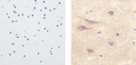 VE-cadherin Antibody in Immunohistochemistry (Paraffin) (IHC (P))