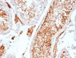 Inhibin, alpha (INHA) Antibody in Immunohistochemistry (Paraffin) (IHC (P))