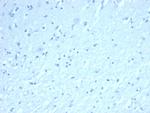 Inhibin, alpha (INHA) Antibody in Immunohistochemistry (Paraffin) (IHC (P))