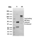 Inhibin, alpha (INHA) Antibody in SDS-PAGE (SDS-PAGE)