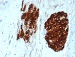 Inhibin, alpha (INHA) Antibody in Immunohistochemistry (Paraffin) (IHC (P))