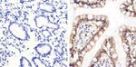 CD138 Antibody in Immunohistochemistry (Paraffin) (IHC (P))