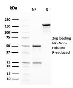 Insulin/IRDN (beta-Cell and Insulinoma Marker) Antibody in SDS-PAGE (SDS-PAGE)