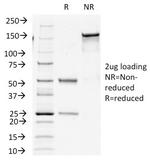 Insulin/IRDN (beta-Cell and Insulinoma Marker) Antibody in SDS-PAGE (SDS-PAGE)