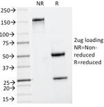 Insulin/IRDN Antibody in SDS-PAGE (SDS-PAGE)