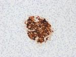 Insulin/IRDN Antibody in Immunohistochemistry (Paraffin) (IHC (P))