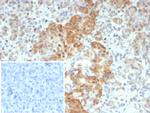 INSM1 (Pan-Neuroendocrine Marker) Antibody in Immunohistochemistry (Paraffin) (IHC (P))