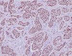 INSM1 (Pan-Neuroendocrine Marker) Antibody in Immunohistochemistry (Paraffin) (IHC (P))