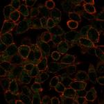 IRF3 Antibody in Immunocytochemistry (ICC/IF)