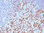 MUM1/IRF4 (Transcription Factor) Antibody in Immunohistochemistry (Paraffin) (IHC (P))