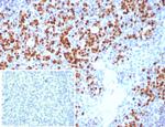 MUM1/IRF4 (Transcription Factor) Antibody in Immunohistochemistry (Paraffin) (IHC (P))