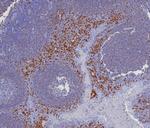 MUM1/IRF4 (Transcription Factor) Antibody in Immunohistochemistry (Paraffin) (IHC (P))