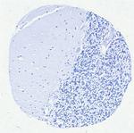 MUM1/IRF4 (Transcription Factor) Antibody in Immunohistochemistry (Paraffin) (IHC (P))