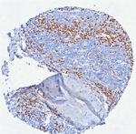 MUM1/IRF4 (Transcription Factor) Antibody in Immunohistochemistry (Paraffin) (IHC (P))