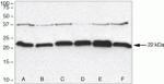 Syndecan 2 Antibody in Western Blot (WB)