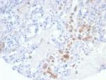 IRS1 (Insulin receptor substrate 1) Antibody in Immunohistochemistry (Paraffin) (IHC (P))