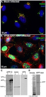 beta Amyloid Antibody in Western Blot, Immunocytochemistry (WB, ICC/IF)